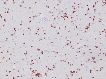 OLIG2 Antibody