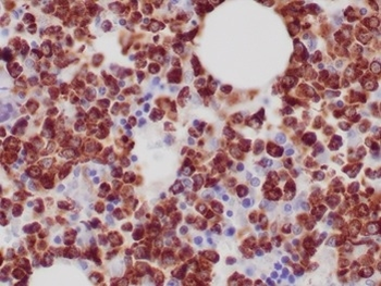 MPO Antibody