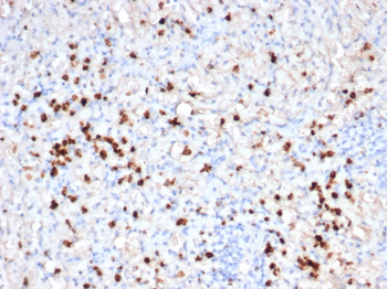 GZMB Antibody