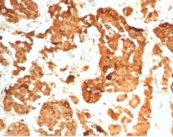 CGB3, CGB5, CGB8, NA Antibody