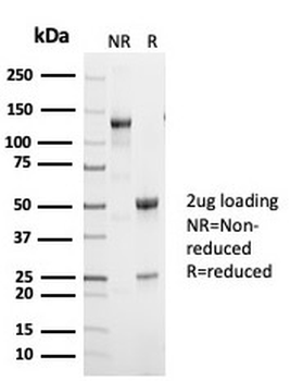 TP53 Antibody