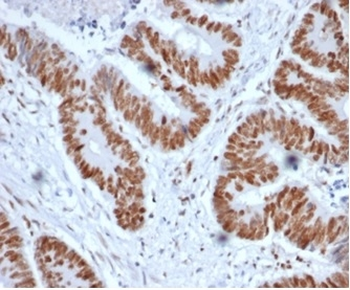 MSH2 Antibody