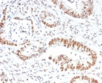 MSH2 Antibody