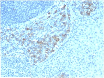 CD5L / CD5LG / CD5 Ligand Antibody