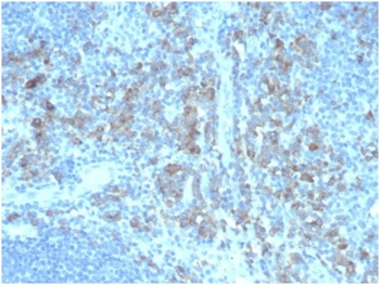 CD5L / CD5LG / CD5 Ligand Antibody