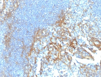 ICAM1 Antibody