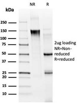 MED21 Antibody