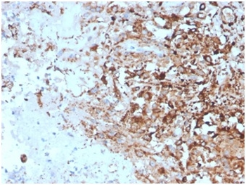 HAVCR2 Antibody