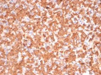 PRKCI Antibody