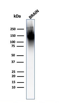 Neurofilament (H+L) (Neuronal Marker) Antibody