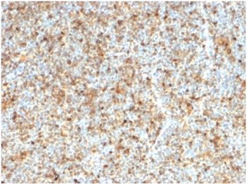 LMO2 Antibody