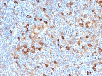 FSCN1 Antibody