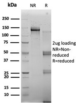 RBMS2 Antibody