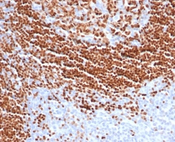 SOX11 Antibody