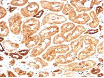 AKR1B1 Antibody