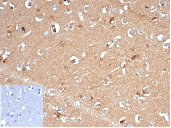 AKR1B1 Antibody