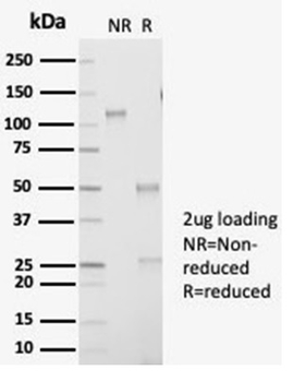 AKR1B1 Antibody