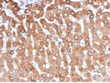 HP Antibody