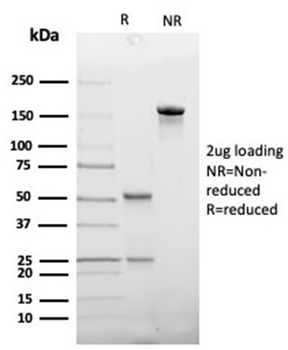 HP Antibody