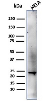 CBFB Antibody