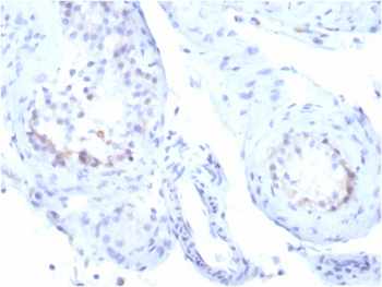 STAR Antibody