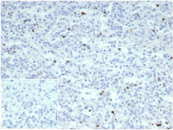 PRF1 Antibody