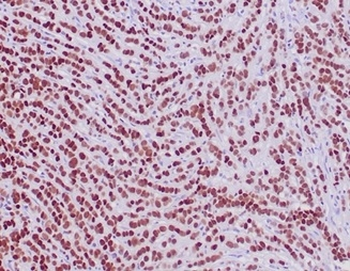 GATA3 Antibody