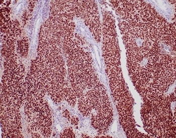 GATA3 Antibody