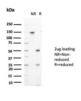 GLUL Antibody