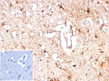 S100B Antibody