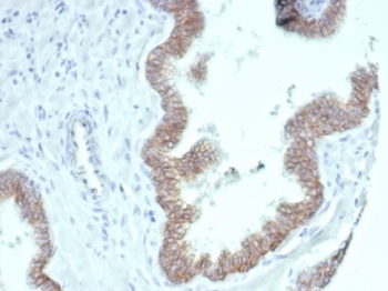 CTNNB1 Antibody