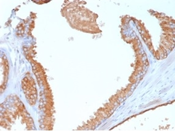 GPC3 Antibody