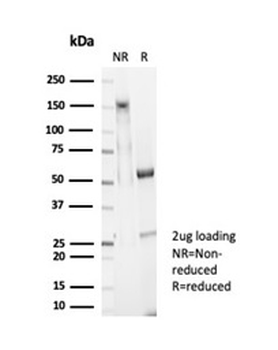 GPC3 Antibody
