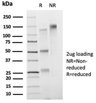 FOXB1 Antibody