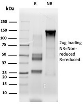 ETS2 Antibody