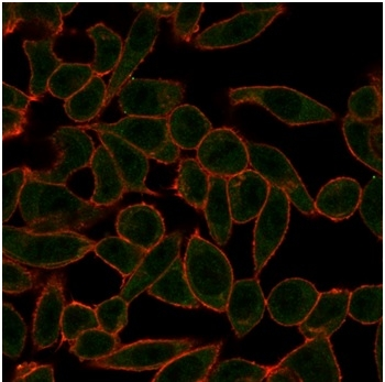 ETS2 Antibody