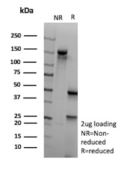 GLUL Antibody