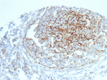 CR1 Antibody