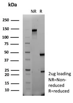 CR1 Antibody