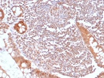 SMAD4 Antibody