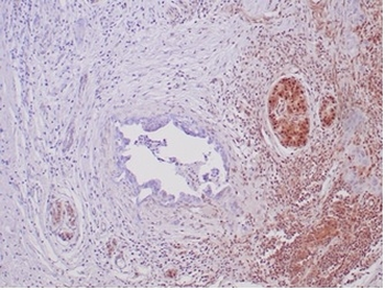 SMAD4 Antibody