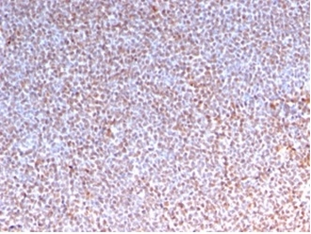 ALK Antibody