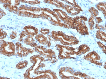 AMACR Antibody
