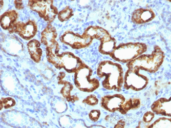 AMACR Antibody