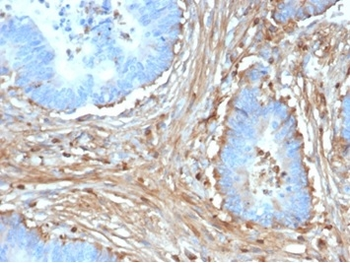 FBN1 Antibody