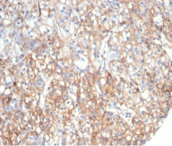 FBN1 Antibody
