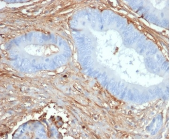 FBN1 Antibody