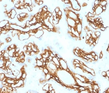FBN1 Antibody