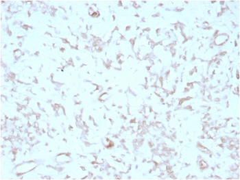 FERMT2 Antibody