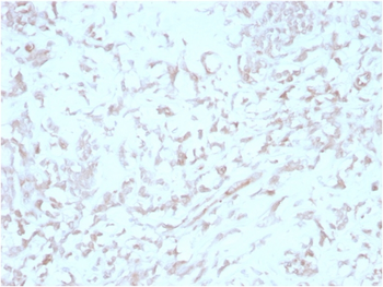 FERMT2 Antibody